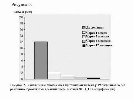 injecție etanol percutana în tratamentul bolilor tiroidiene