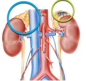 Pheochromocytoma külleme törlése és előrejelzés