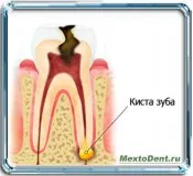 periuta de dinti - Articolul pe